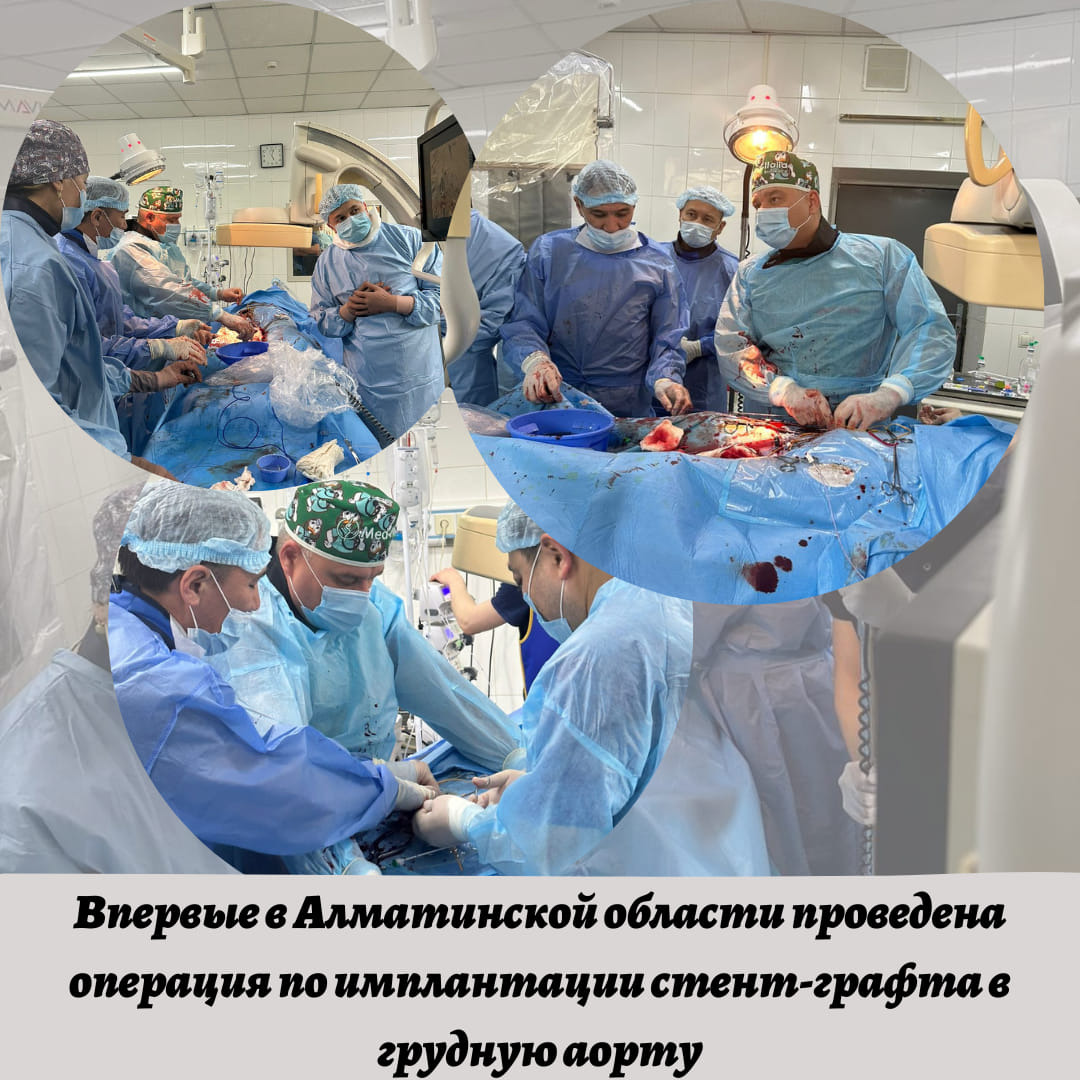 На базе Алматинской многопрофильной клинической больницы впервые проведена высокотехнологичная и гибридная операция по имплантации стент-графта в грудную аорту. На базе Алматинской многопрофильной клинической больницы впервые проведена высокотехнологичная и гибридная операция по имплантации стент-графта в грудную аорту.