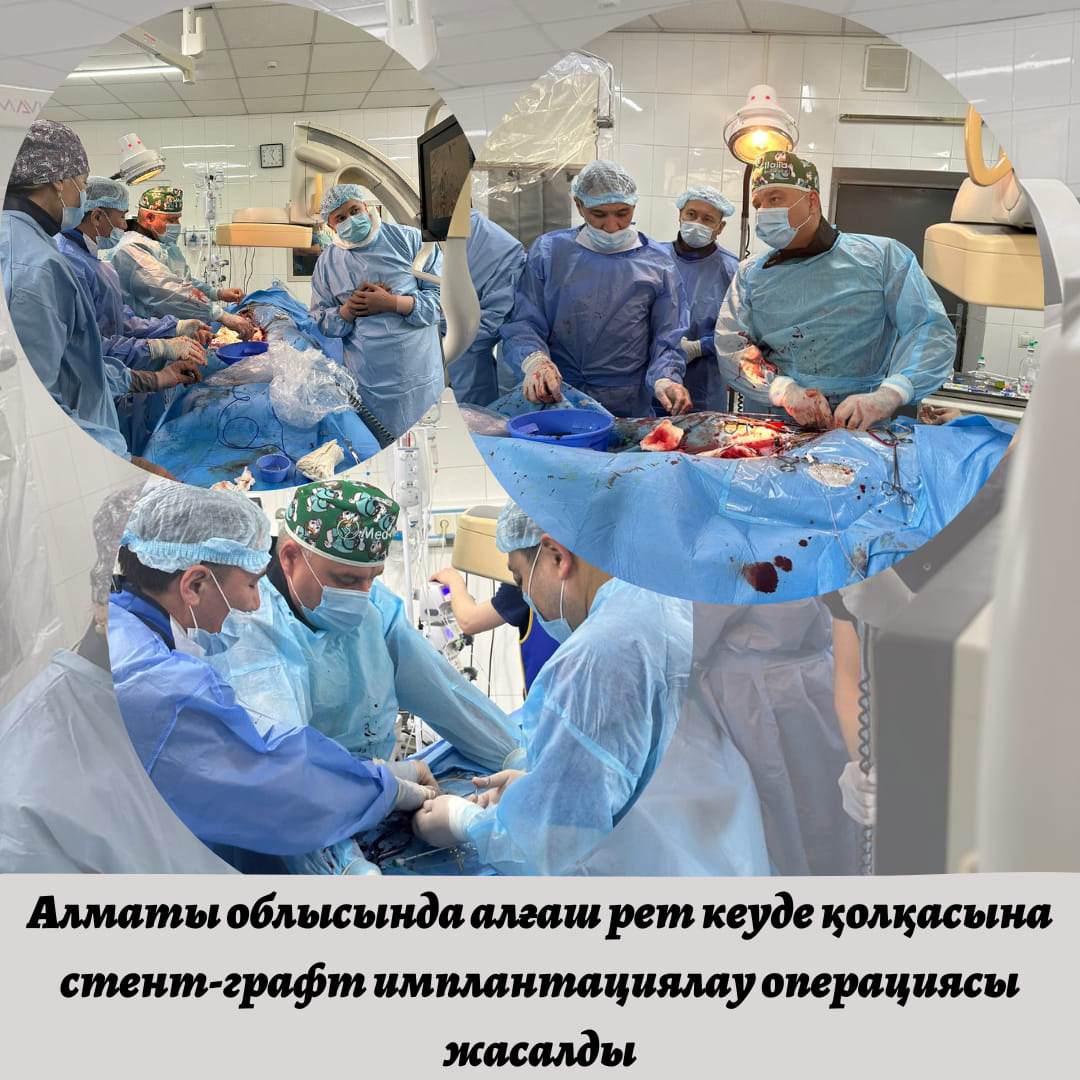 Алматы көпсалалы клиникалық ауруханасының базасында алғаш рет кеуде қолқасына стент-графт имплантациялау бойынша жоғары технологиялық және гибридті ота 1953 жылы туған науқасқа жасалды.